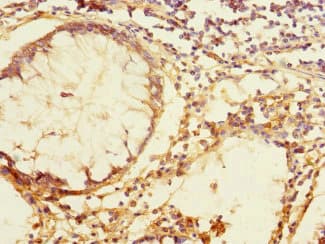 TEX43 / C5orf48 Antibody