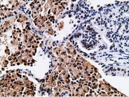 NT5DC1 Antibody (clone OTI1B1)