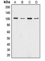 Polyclonal Rabbit anti-Human Alpha 1+2 Catenin Antibody (C-Terminus, IHC, WB)