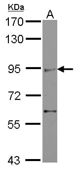 ZIMP7 / ZMIZ2 Antibody