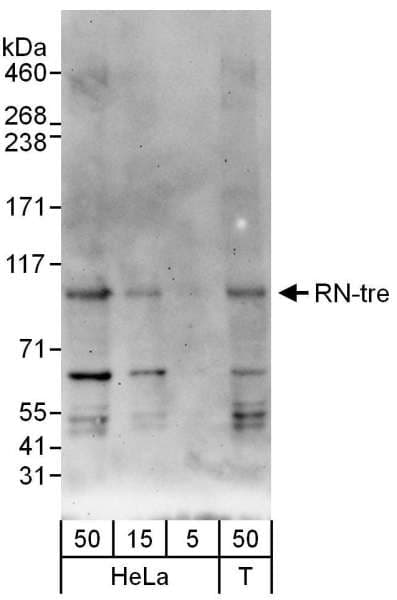 IHC-plus™ USP6NL Antibody (aa350-400)