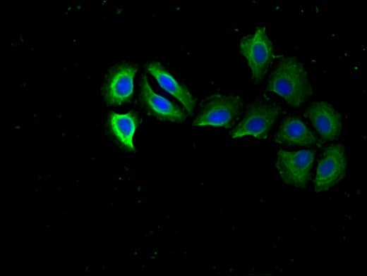 Polyclonal Rabbit anti-Human RPS15 / Ribosomal Protein S15 Antibody (IHC, IF, WB)