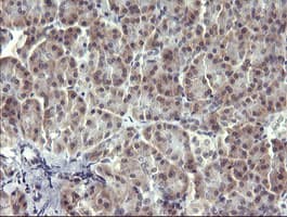 MAPK13 / p38delta Antibody (clone OTI2A10)
