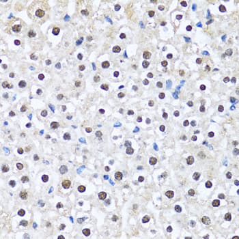 CCAR2 / KIAA1967 Antibody