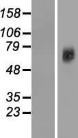 SLC38A7 Protein (Over-Expression Lysate Myc-DDK (Flag))