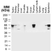 TRAF6 Antibody (aa451-469)