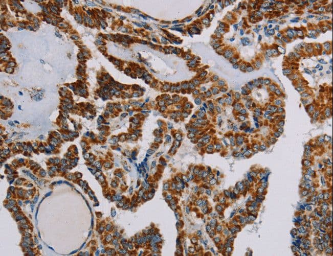 Polyclonal Rabbit anti-Human NDUFS3 Antibody (IHC, WB)