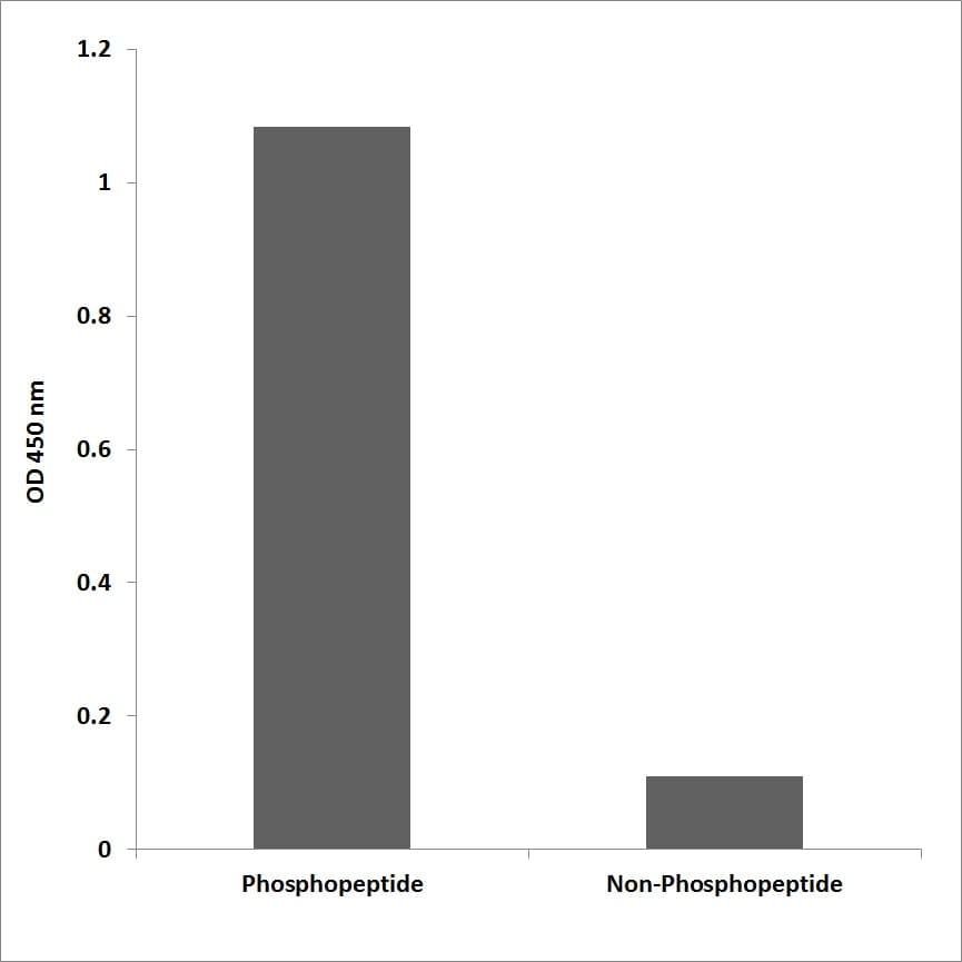 PRKD1 / PKC Mu Antibody (phospho-Ser738)
