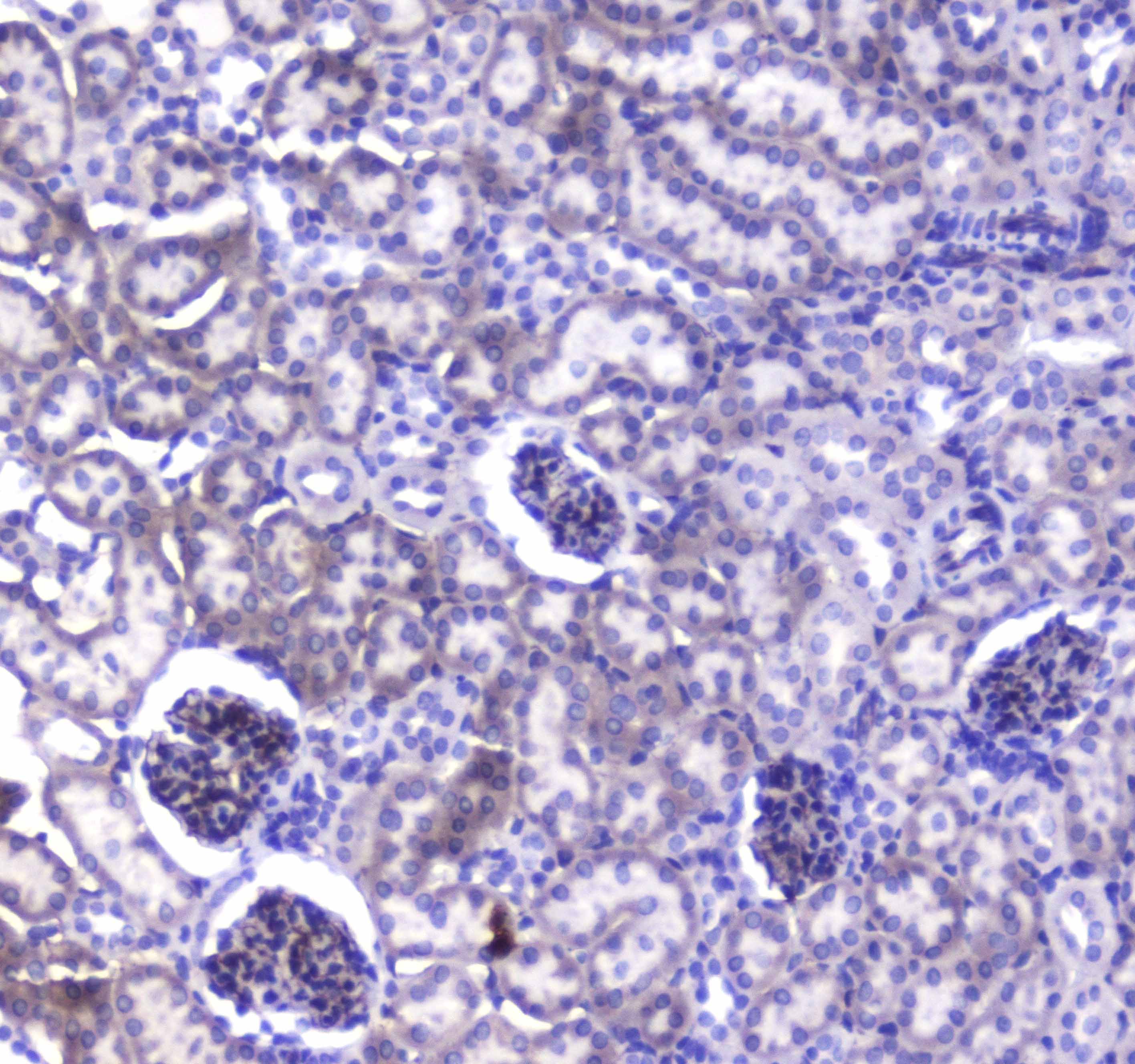 Polyclonal Rabbit anti-Mouse CD144 / CDH5 / VE Cadherin Antibody (IHC, WB)