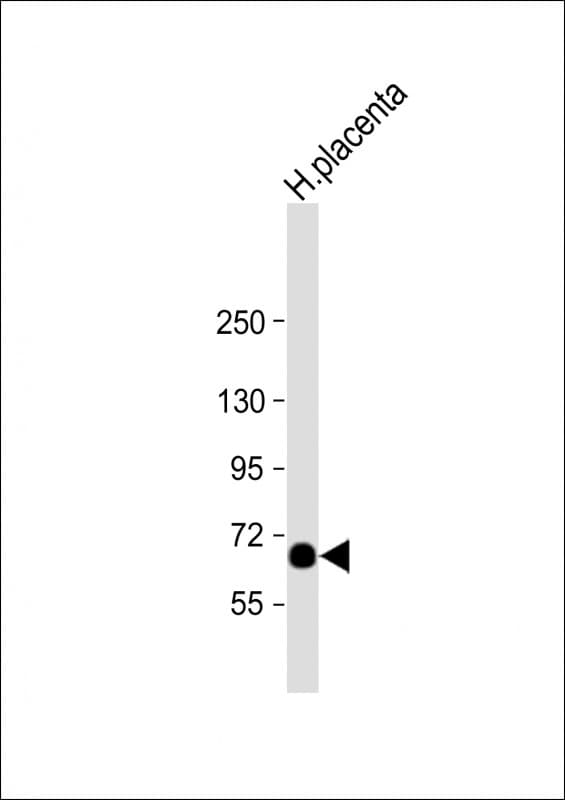 Polyclonal Rabbit anti-Human STT3A / ITM1 Antibody (Internal, WB)