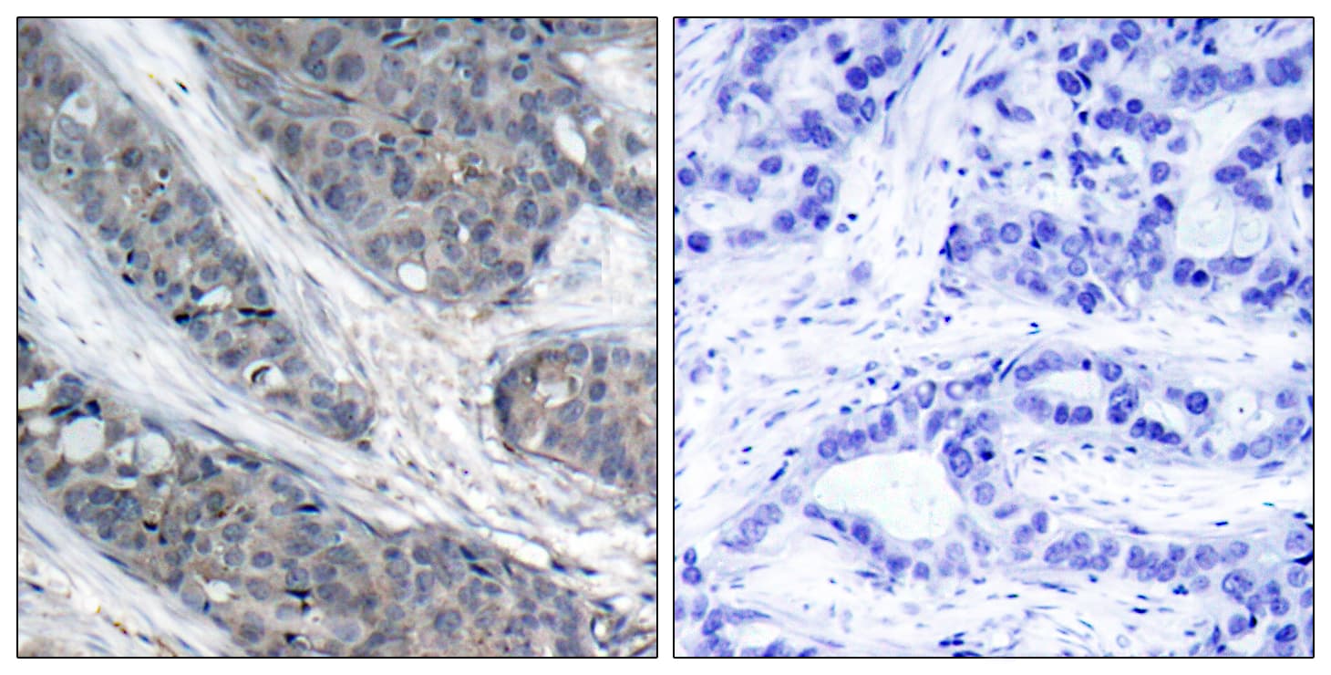 IRS1 Antibody (phospho-Ser307)