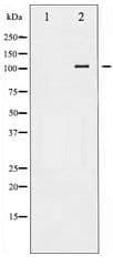 Polyclonal Rabbit anti-Human PRKD1 / PKC Mu Antibody (IHC, WB)