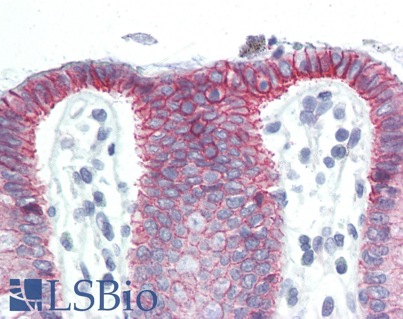 IHC-plus™ Monoclonal Mouse anti-Human CTNNB1 / Beta Catenin Antibody (aa758-771, IHC, WB)