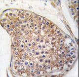 TEK / TIE2 Antibody (aa758-789)