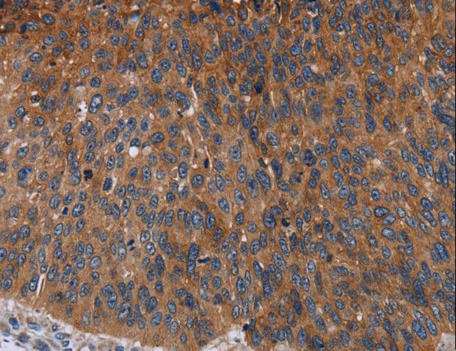 JUP/CTNNG/Junction Plakoglobin Antibody