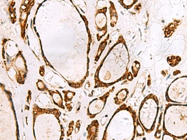 GRWD1 Antibody
