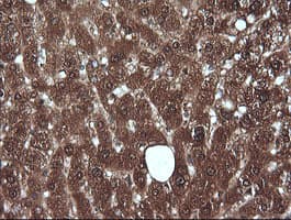 MLANA / Melan-A Antibody (clone OTI3A2)