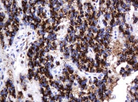 GLB1 / Beta-Galactosidase Antibody (clone OTI1C9)