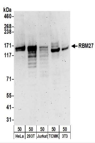 IHC-plus™ RBM27 Antibody (aa700-750)