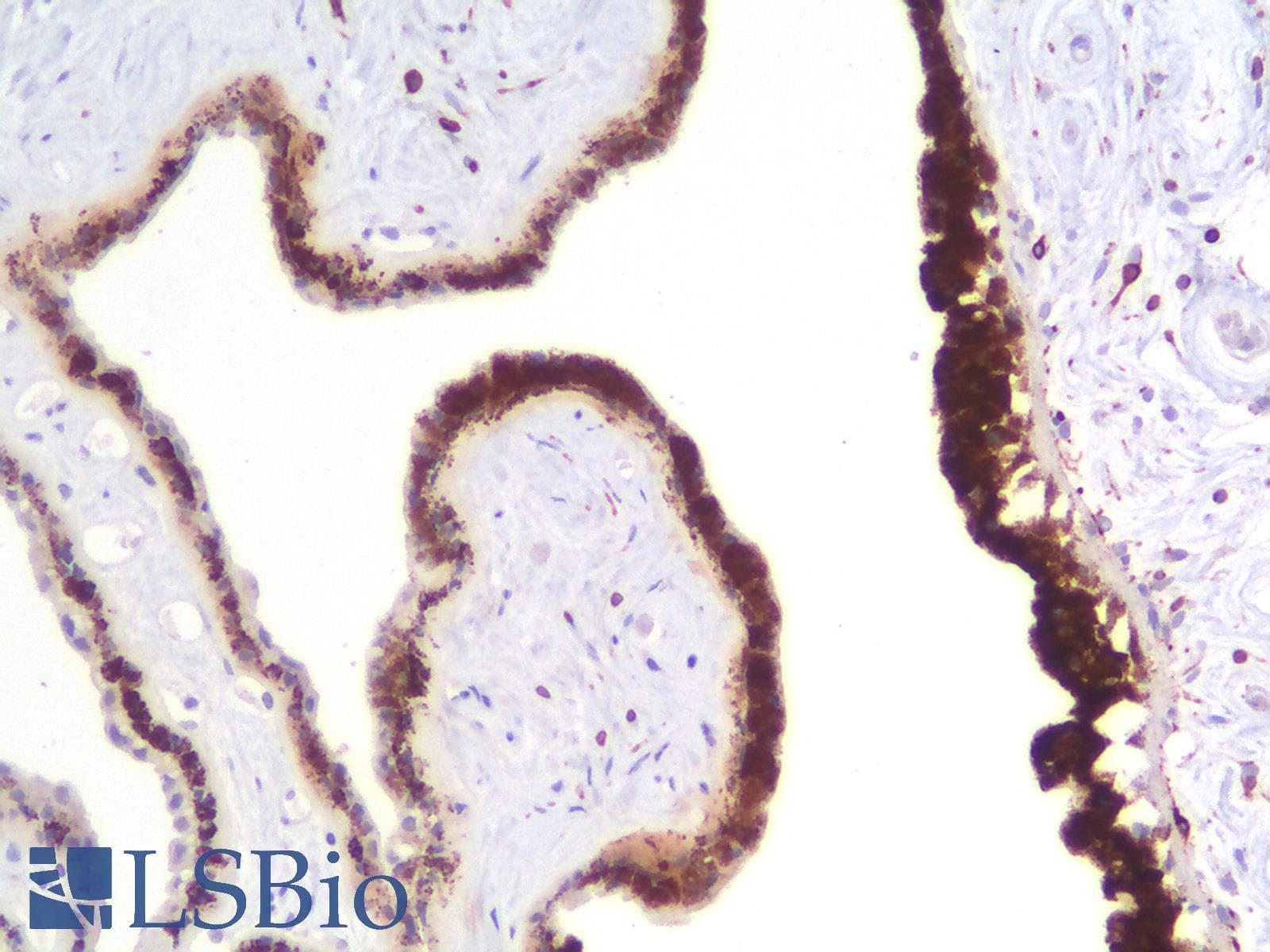 PathPlus™ Recombinant Monoclonal Mouse anti-Human MLANA / Melan-A Antibody (clone rMLANA/788, IHC)