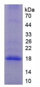 Mouse Properdin / CFP Protein (Recombinant His, N-Terminal)
