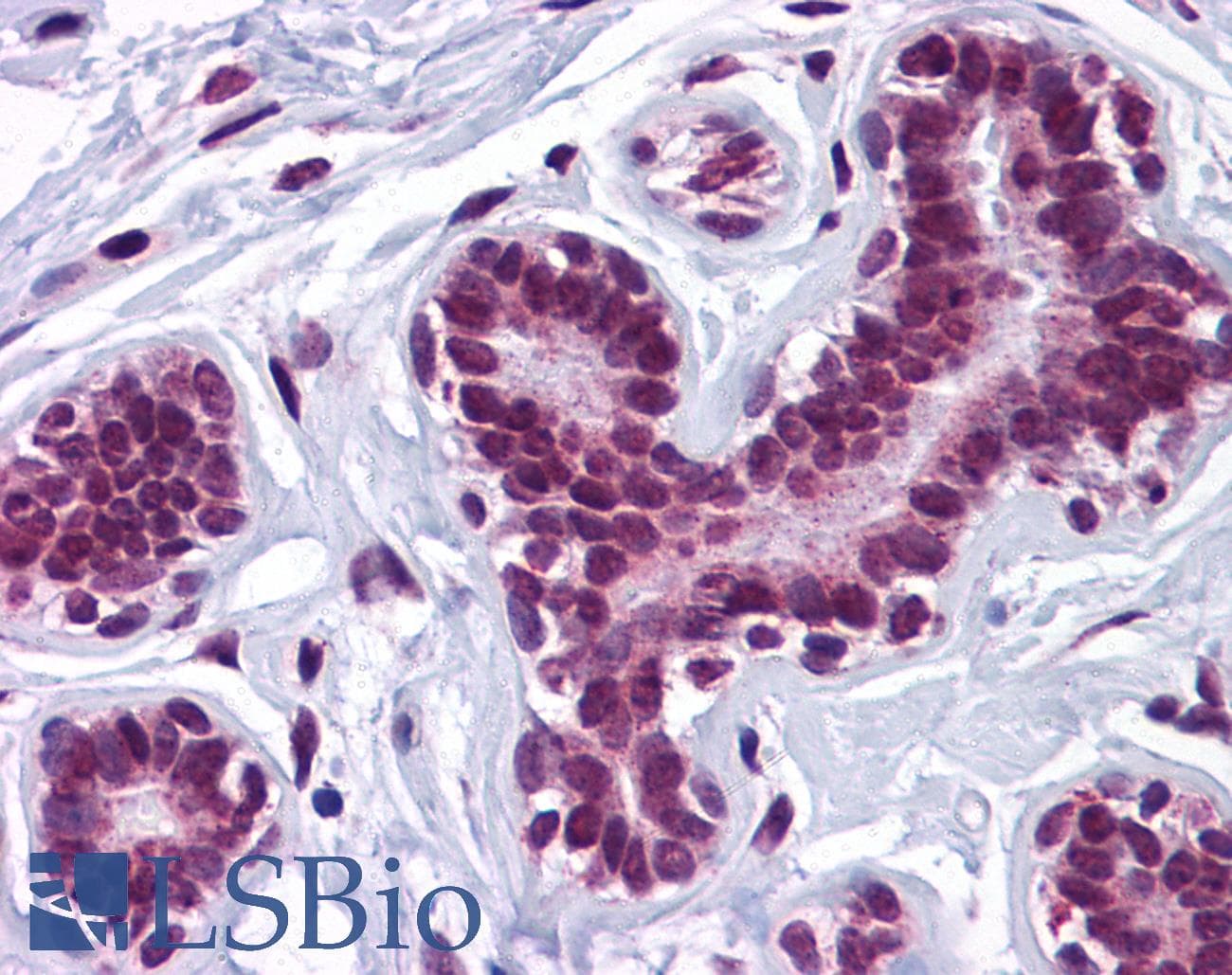 IHC-plus™ QIP1 / KPNA4 Antibody
