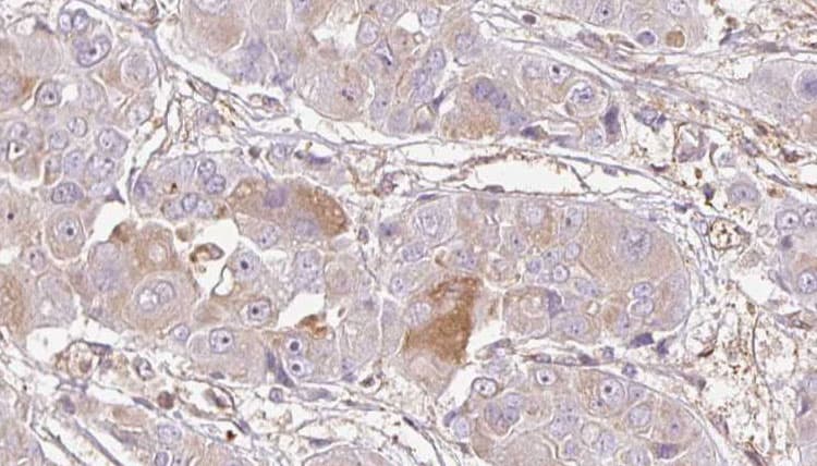 LPAR4 / GPR23 Antibody