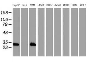 IHC-plus™ NNMT Antibody (clone 3D8)