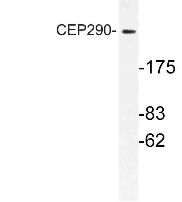 Polyclonal Rabbit anti-Human CEP290 Antibody (Phe812, WB)