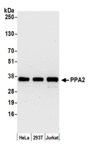 Polyclonal Rabbit anti-Human PPA2 Antibody (aa284-334, WB)