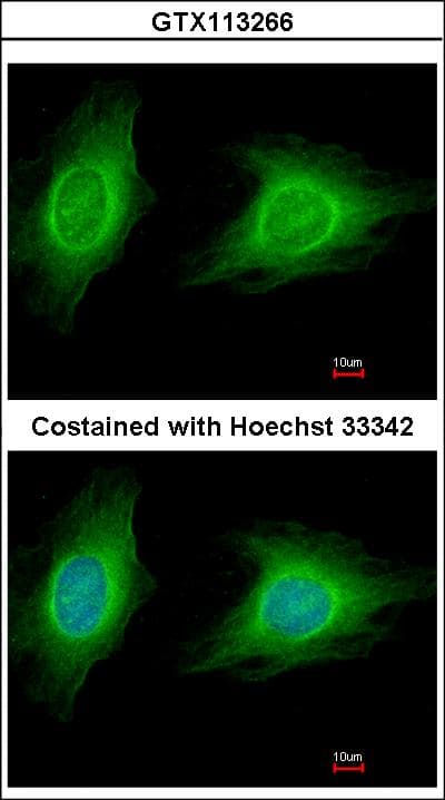 Rho Kinase / ROCK1 Antibody (aa107-371)