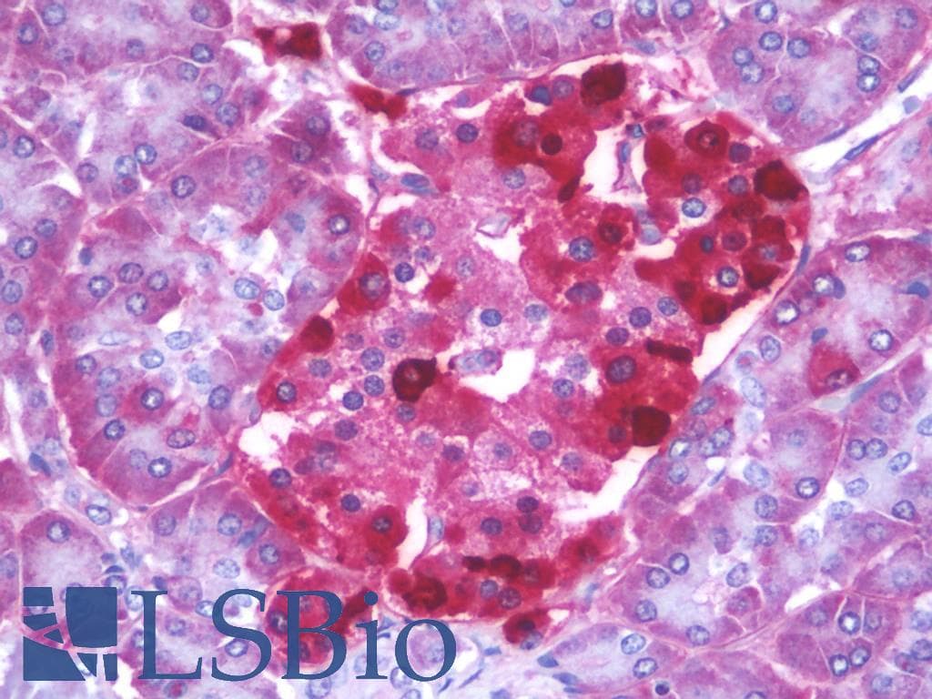 IHC-plus™ Polyclonal Rabbit anti-Human TMEM145 Antibody (aa58-107, IHC, WB)
