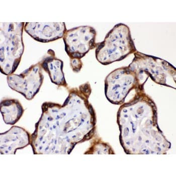 Polyclonal Rabbit anti-Human HSD2 / HSD11B2 Antibody (aa277-309, IHC, WB)