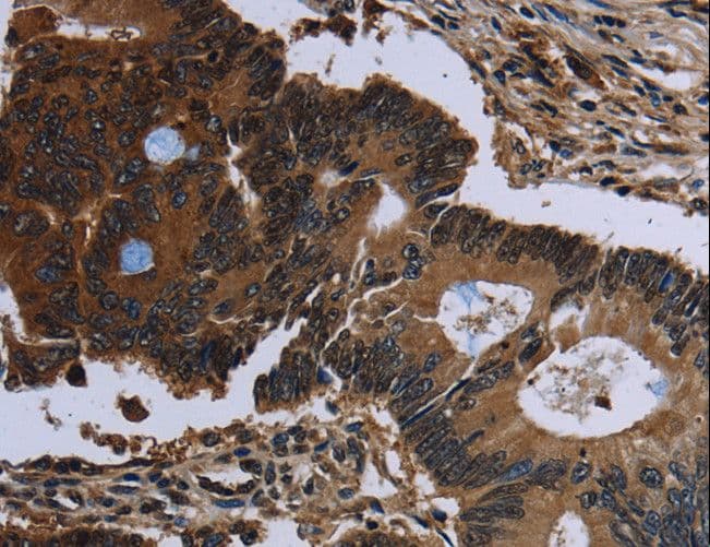 Polyclonal Rabbit anti-Human IRGM / LRG-47 Antibody (IHC, WB)