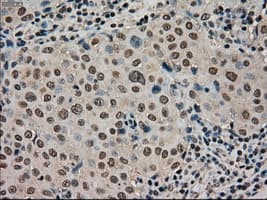 Monoclonal Mouse anti-Human STK39 / SPAK Antibody (clone OTI2E10, IHC, WB)