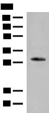 Polyclonal Rabbit anti-Human VDAC3 Antibody (IHC, WB)