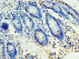 ULBP2 / RAET1H Antibody (aa26-216)