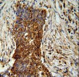 MMP2 Antibody