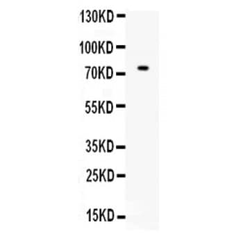 Polyclonal Rabbit anti-Human ZBTB7A / Pokemon Antibody (aa125-163, IHC, WB)