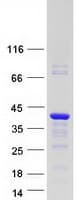 Human VGLL4 Protein (Recombinant Myc-DDK (Flag))