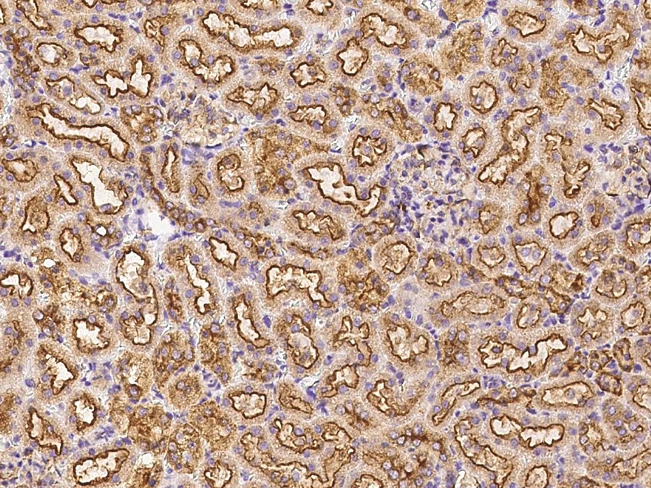 Polyclonal Rabbit anti-Mouse CLTC / Clathrin Heavy Chain Antibody (Preservative Free, IHC, WB)