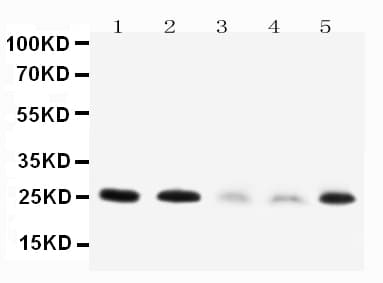 PTN / Pleiotrophin Antibody (aa150-168)