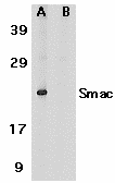 Polyclonal Rabbit anti-Human DIABLO / SMAC Antibody (aa225-239, IHC, WB)