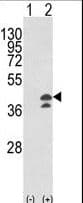 Aspartate Aminotransferase Antibody (aa5-33)