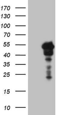 SAMSN1 Antibody (aa1-250, clone OTI1F6)