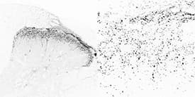 CGRP / Calcitonin Gene-Related Peptide Antibody