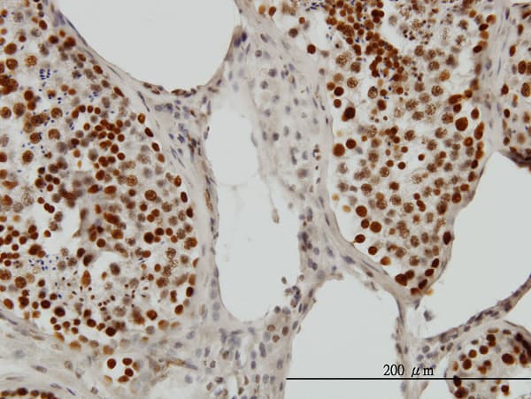 PSIP1 / LEDGF Antibody (clone 3H1)