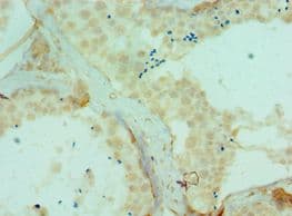 DYRK2 Antibody (aa502-601)
