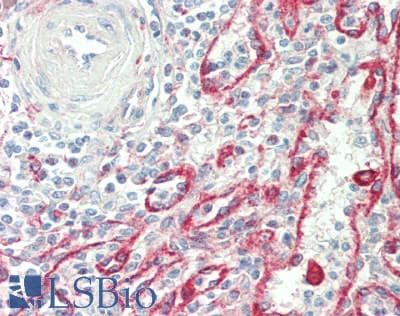 IHC-plus™ FCGRT / FCRN Antibody