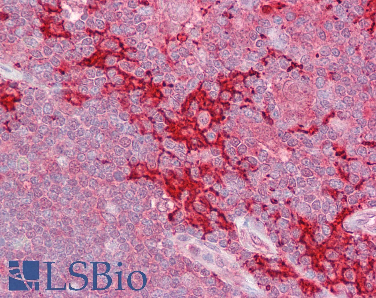 IHC-plus™ MAP4K1 / HPK1 Antibody (aa2-14)